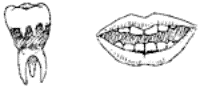 Drawing of a mouth showing teeth and a diagram of a tooth.