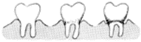 Side view drawing of teeth, roots, and gums.